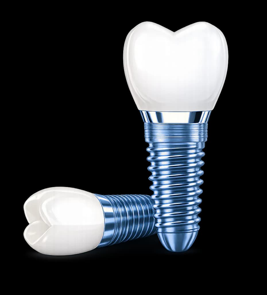 Dental Implants