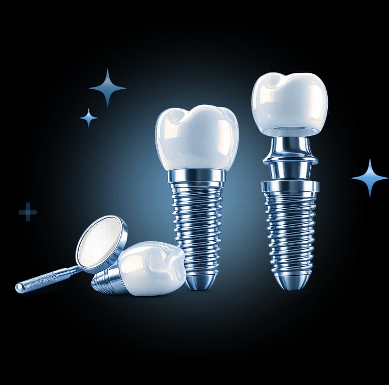 Dental Implants